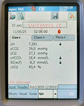 Caso clinico 13: una paresi anomala