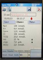 Scarsa produzione di origine metabolica ...